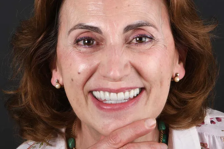 Después · Implantes + Carillas de cerámica