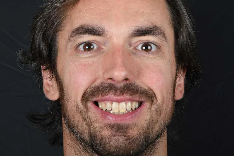 Antes · Carillas e implantes dentales