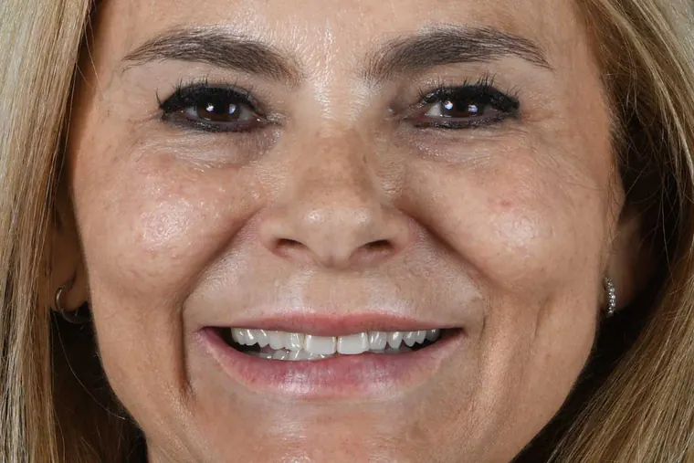 Antes · Carillas de cerámica sin tallado