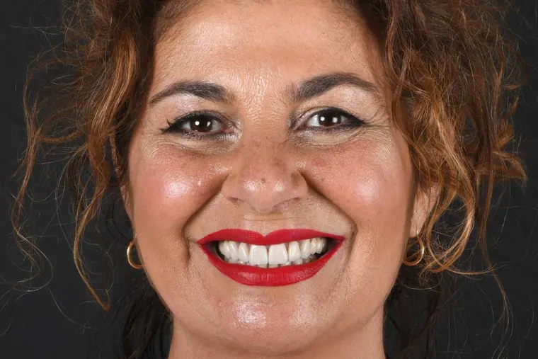 Después · Ortodoncia + Carillas